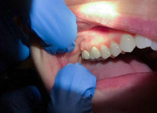 Best Cosmetic Emergency Dentistry in Ashton Sandy Spring, MD